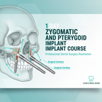 1 Day Zygomatic and Pterygoid Implant Course Banner