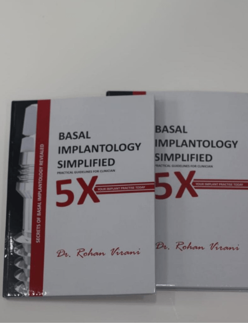 basal-implantology-simplife-dental-implant-book