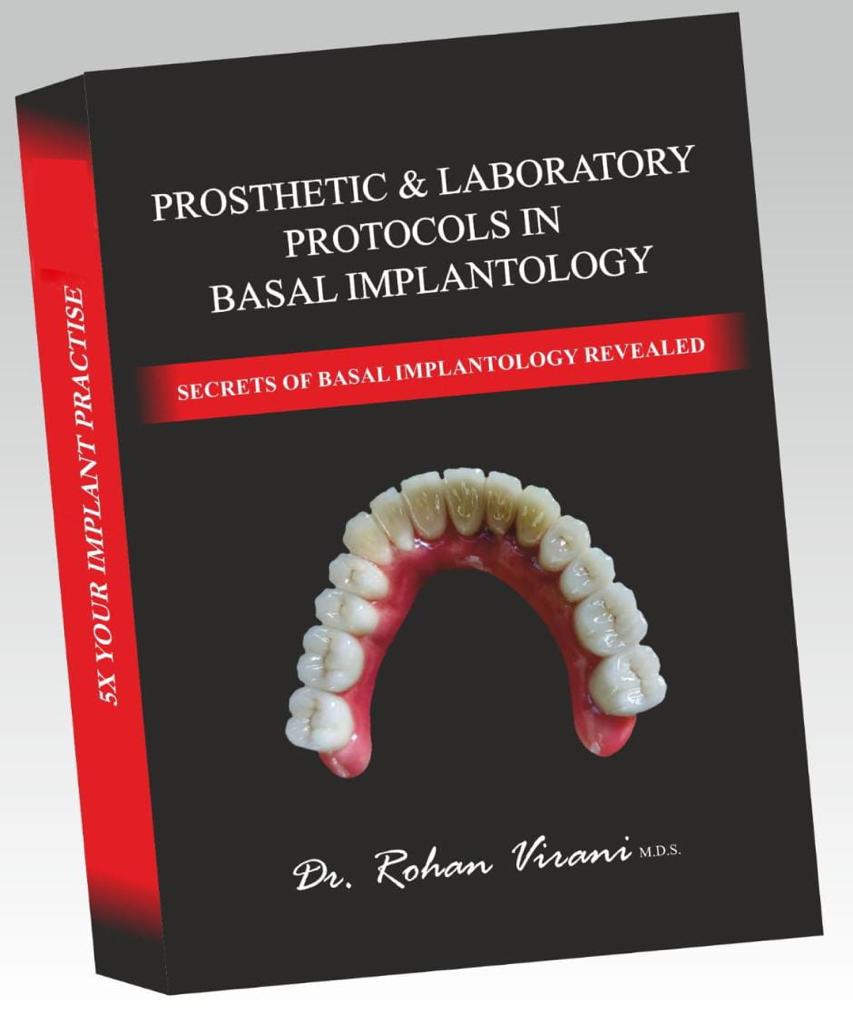 Basal implant prosthetic book